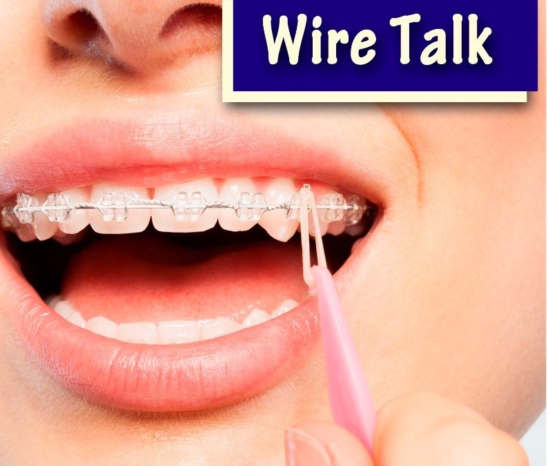 wire elastic braces