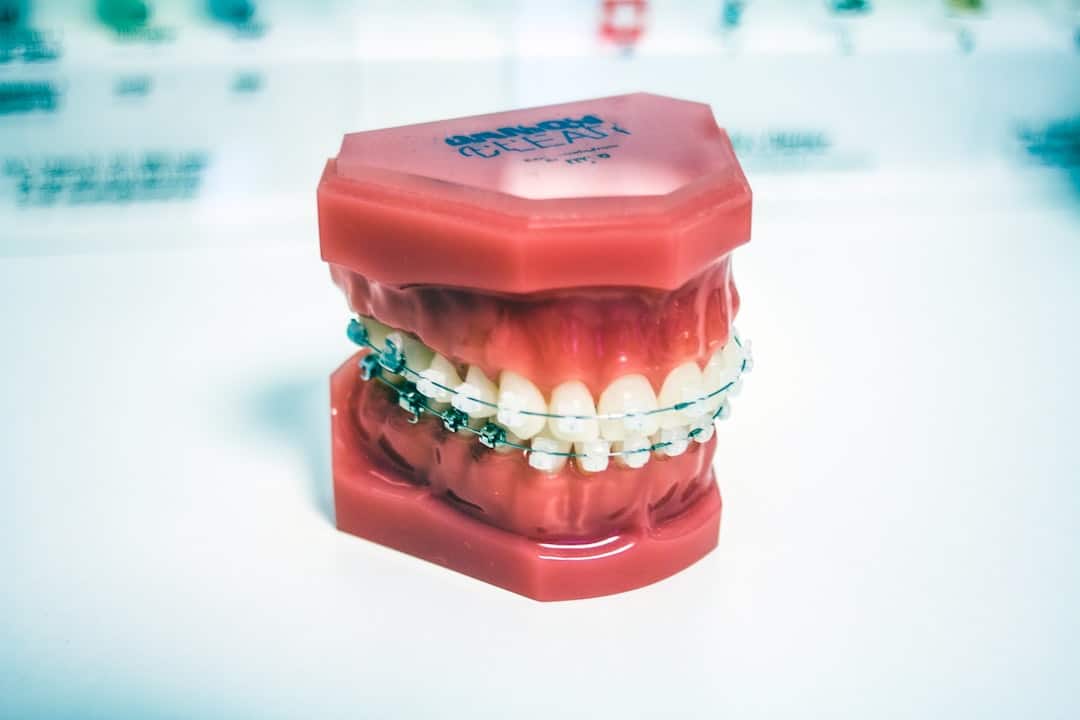 What Are the Signs You Need Braces?